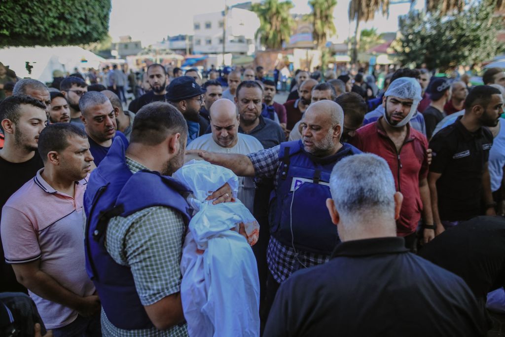Al Jazeera correspondent Wael Al-Dahdouh receives medical treatment at Nasser Hospital after being wounded in Khan Yunis, Gaza on December 15, 2023.Hani Alshaer—Anadolu/Getty Images